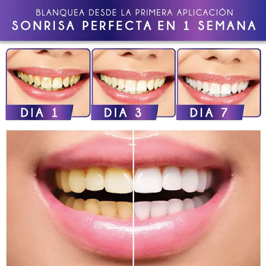 Sonrisa Radiante V34™️.